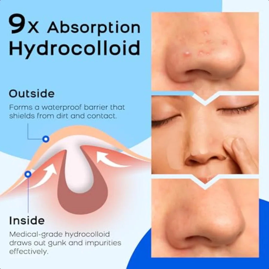 Pimple Patches for Nose Cover Nose Pimples Overnight Hydrocolloid Acne Patches Absorbs Oil Overnight Facial Skin Care Products