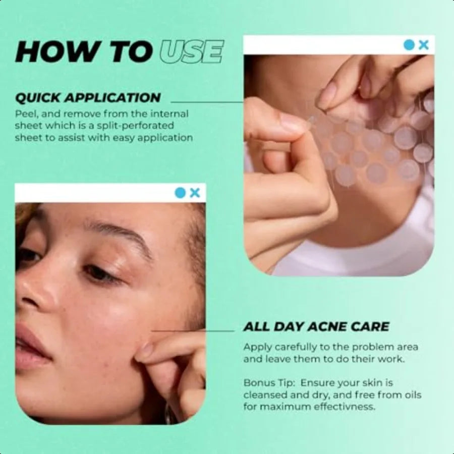 Extra gth Pimple Patches Acne Patches for Face and Skin for Covering Blemishes Korean Skin Care 92 Count 4 x 23 Pack
