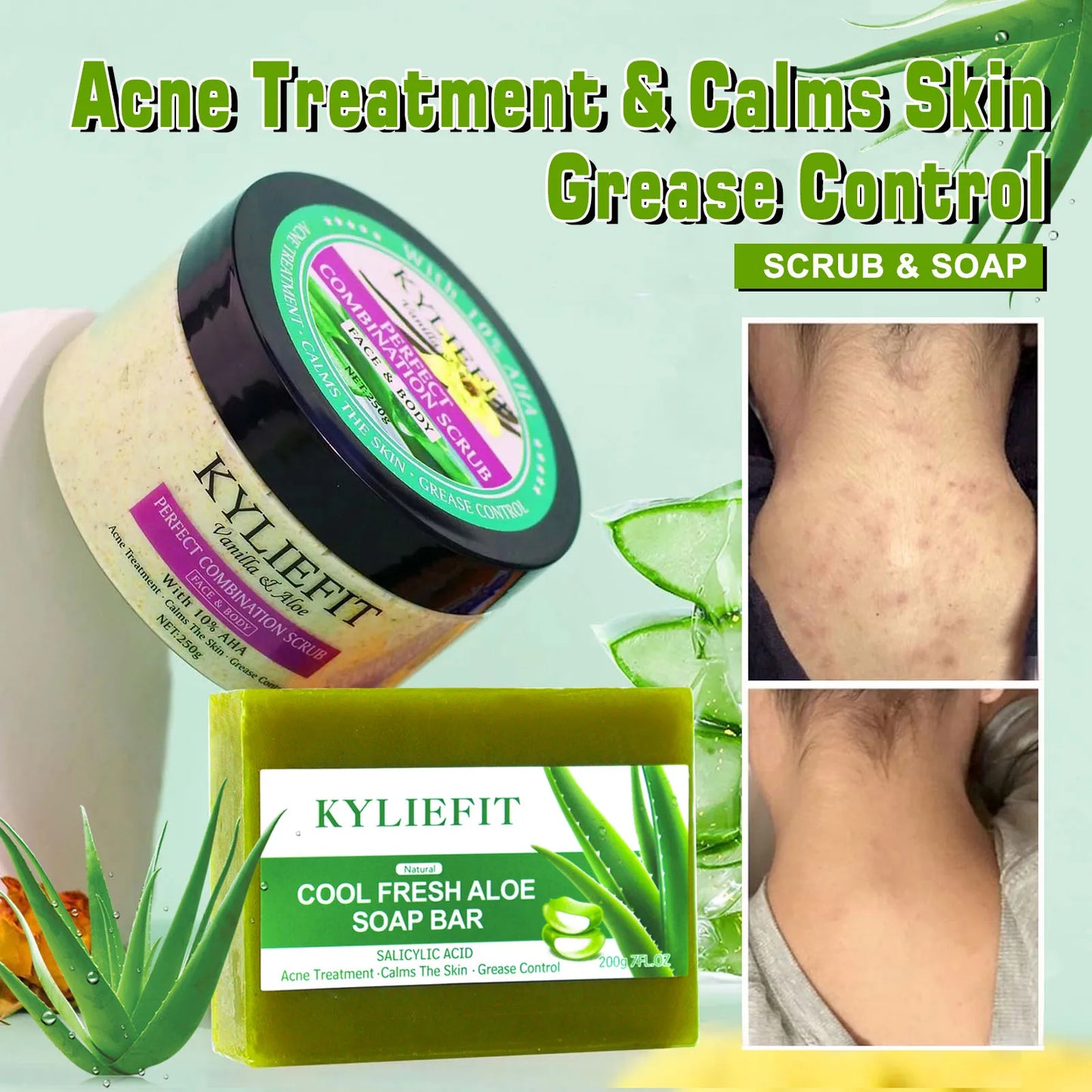 Ailke Aloe Vera Whitening Soap For All Skin Types Acne